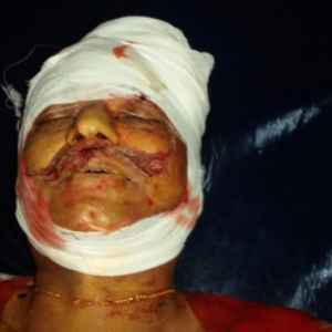 हिन्दुवन के मुसलमान बनावे  वाला टीपू के समर्थक हिन्दू नेता के मार दिहलेंं